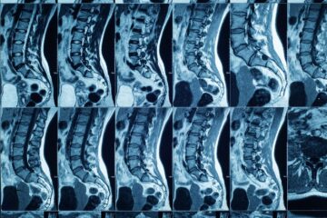 Short Bore MRI in New Jersey: Advanced Technology Driven
